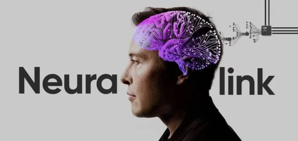 Cultura el inicio de los implantes neuronales 3
