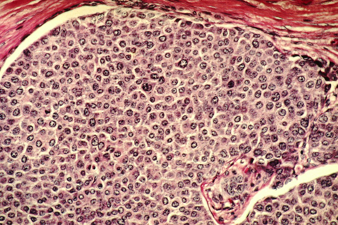 Ciencia inmunoterapia oncologica 1