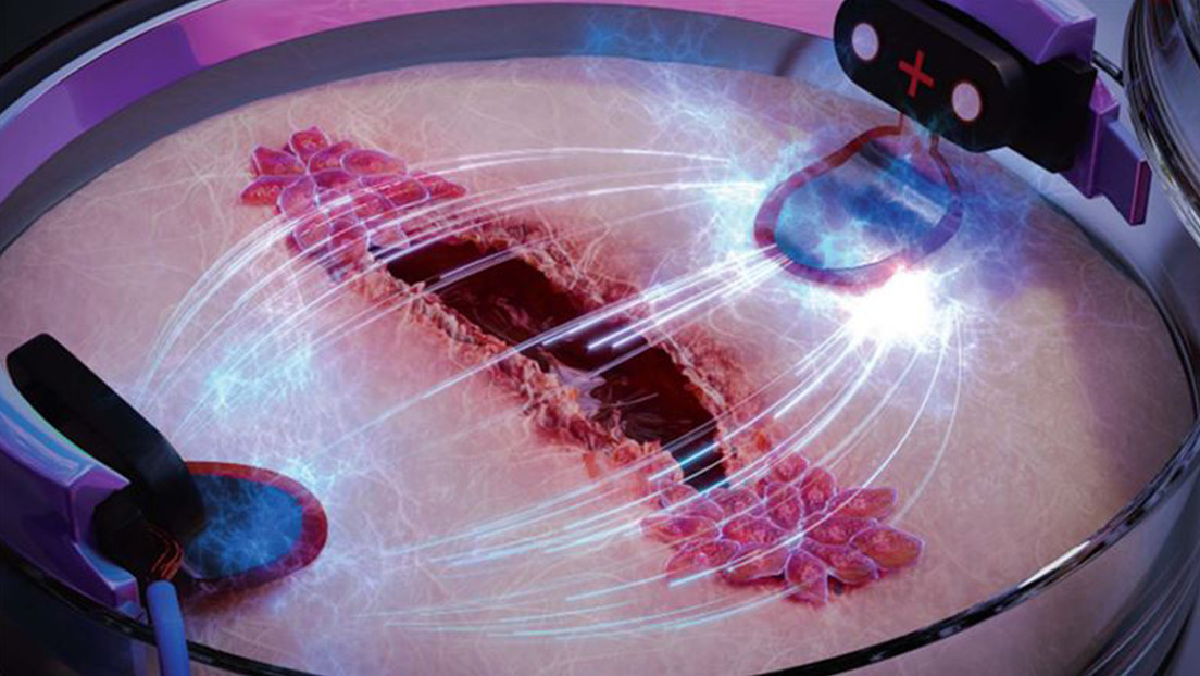 Ciencia la electricidad puede curar cicatrices 2