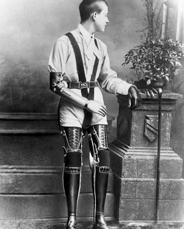 Antes de fabricar prótesis, James Gillingham hacía botas y zapatos
