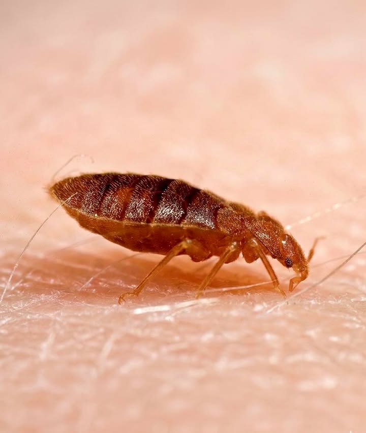 Esa sensación que te invade cuando te acuestas y, justo cuando estás por dormir, comienza una picazón incontrolable