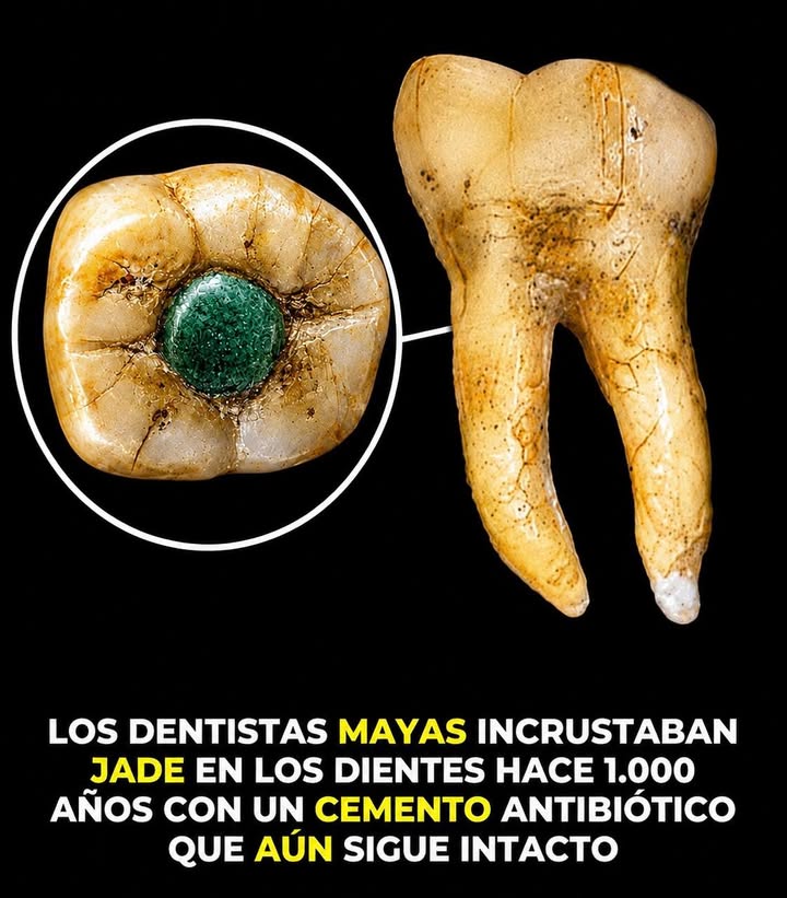 🦷✨ Los mayas practicaban una odontología muy avanzada para su época