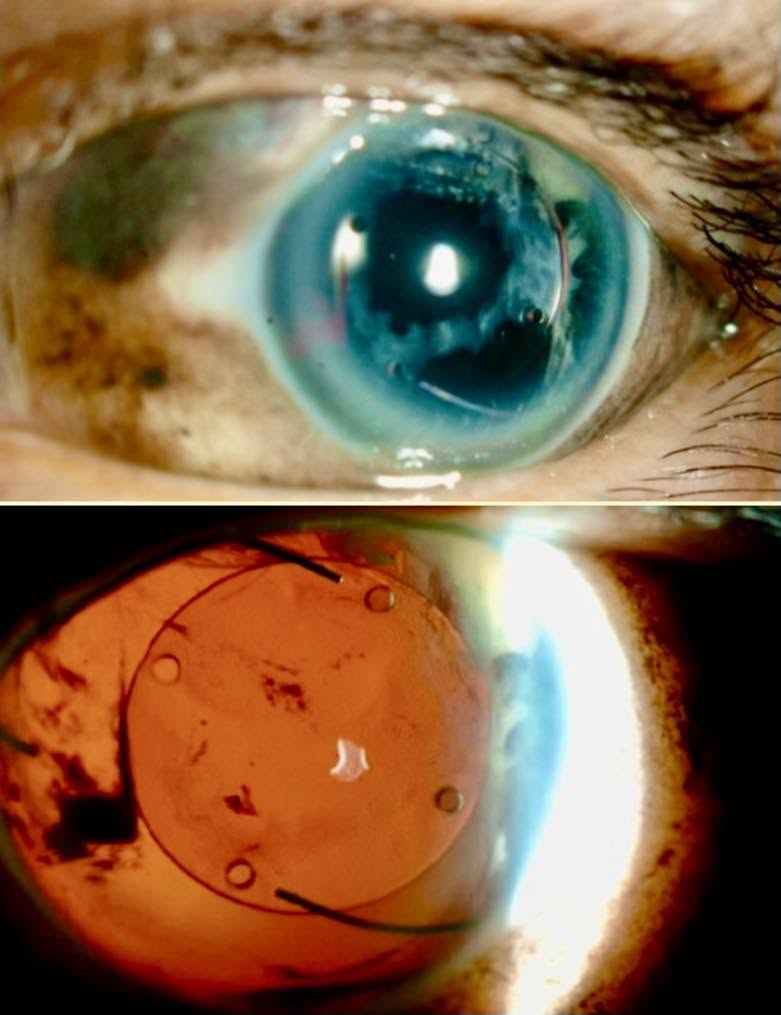Imagina que tus ojos, esas ventanas al mundo, son en realidad un territorio extraño para tu propio cuerpo