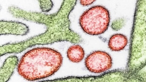El virus Nipah es un patógeno zoonótico identificado por primera vez en 2026 y asociado a brotes esporádicos, principalmente en el sur y sudeste as...