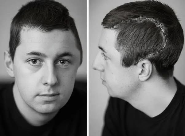 Lewis Godfrey tenía 23 años cuando su vida se rompió en cuestión de minutos