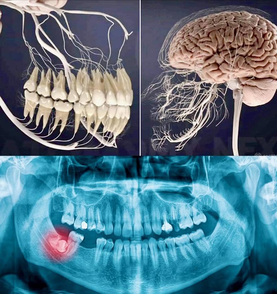 Cualquiera que haya sufrido de dolor de muelas conoce bien el dolor que proviene de él