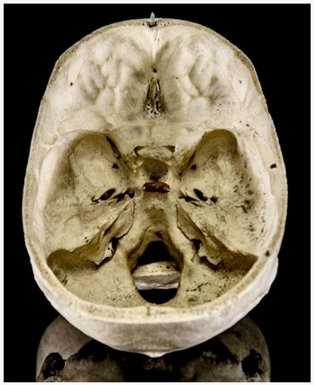 Esta imagen muestra lo que es el interior del cráneo humano