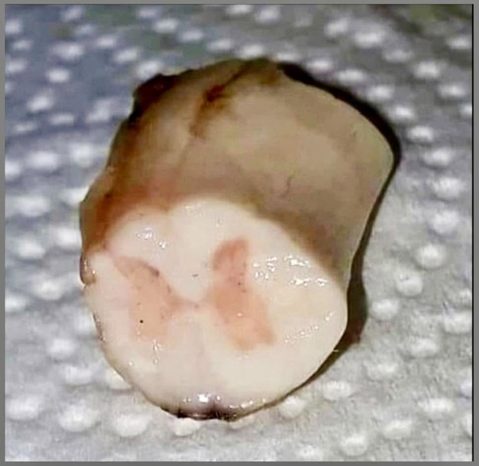 La médula espinal es una parte importante del sistema nervioso que conecta el cerebro con el resto del cuerpo
