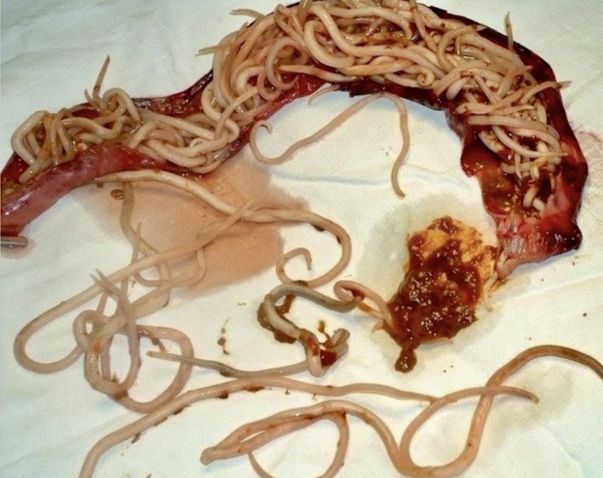 El *Ascaris lumbricoides*, conocido como el nematodo humano, es un parásito que causa ascariasis, una de las infecciones intestinales más comunes en...