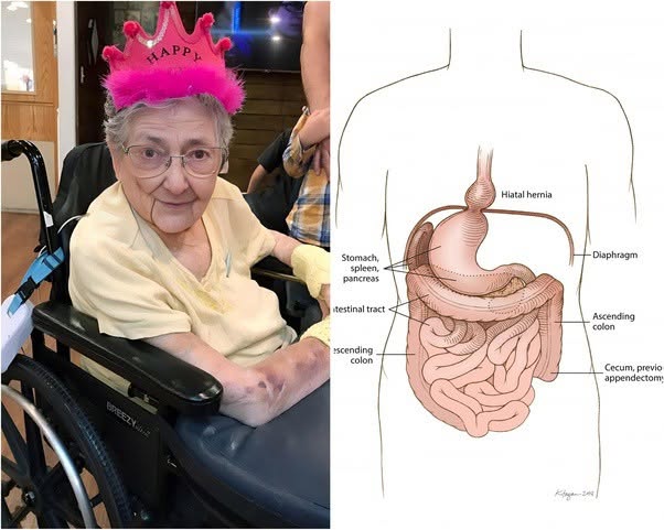 A veces, el cuerpo humano guarda secretos durante toda una vida