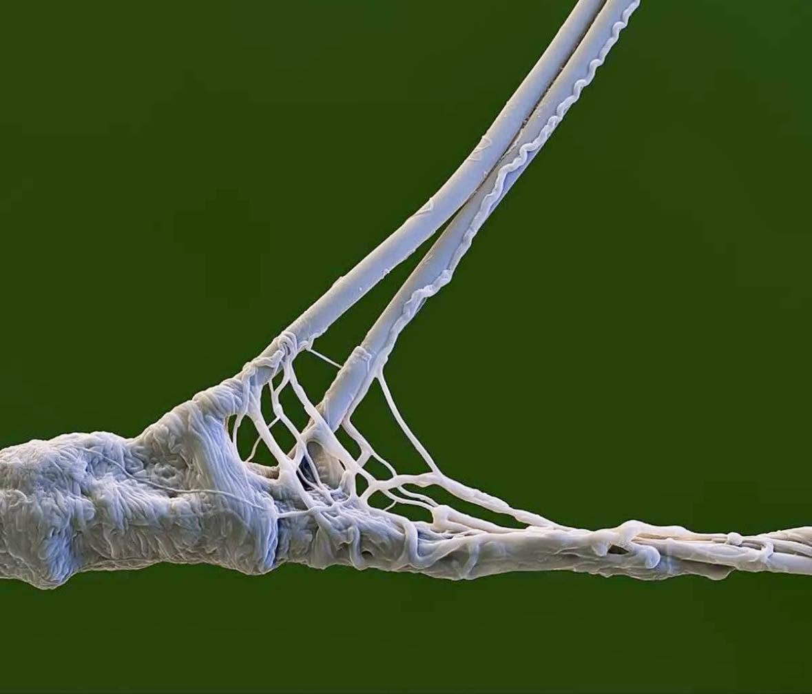 Una telaraña vista a través de un microscopio electrónico