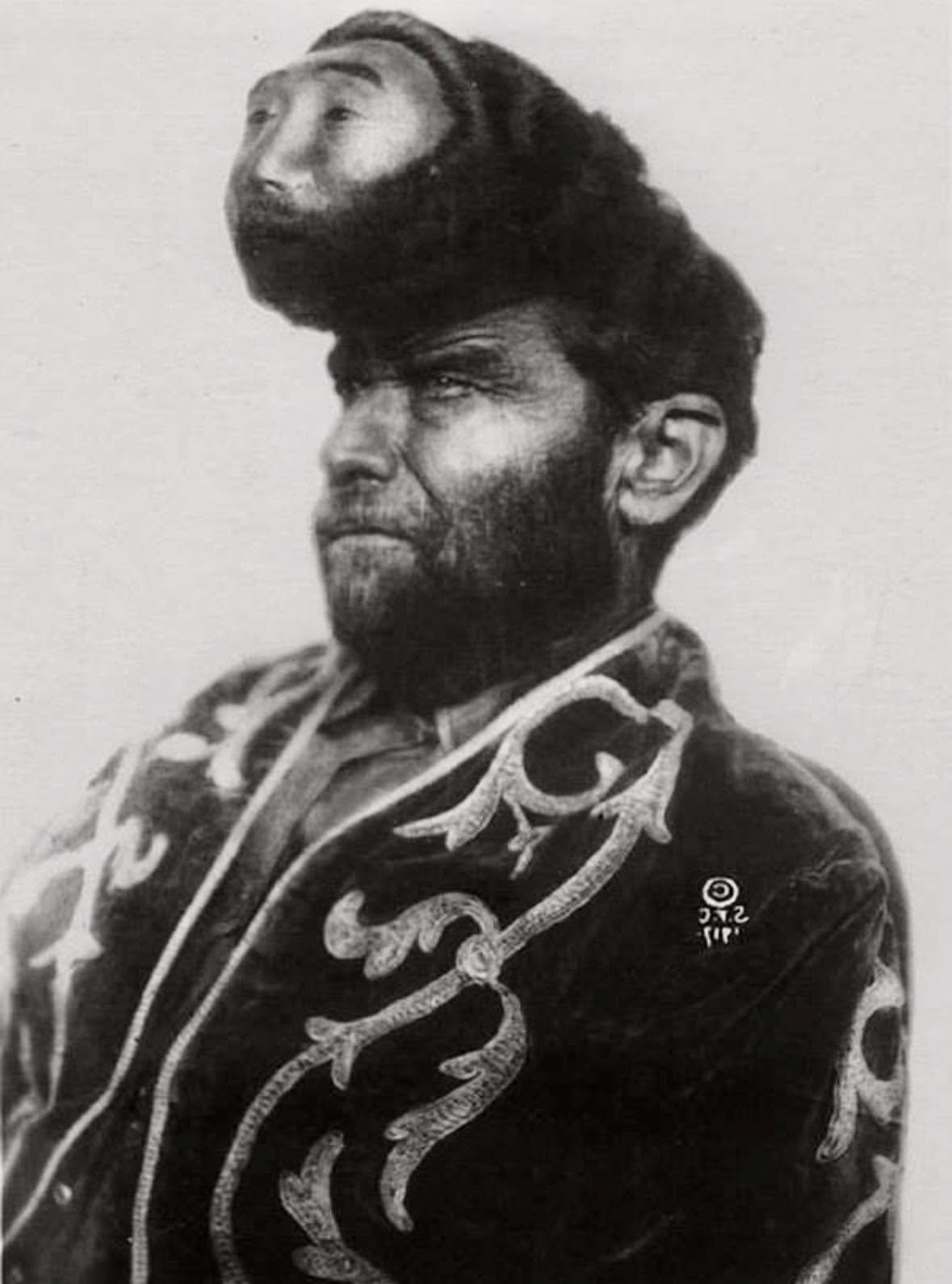 No es necesario buscar mucho para encontrar imágenes inquietantes de los monstruos de circo de la era victoriana, un tiempo en el que el público pag...