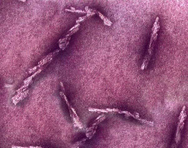 Los priones son una de las formas más extrañas y desconcertantes de “agente infeccioso” que existen