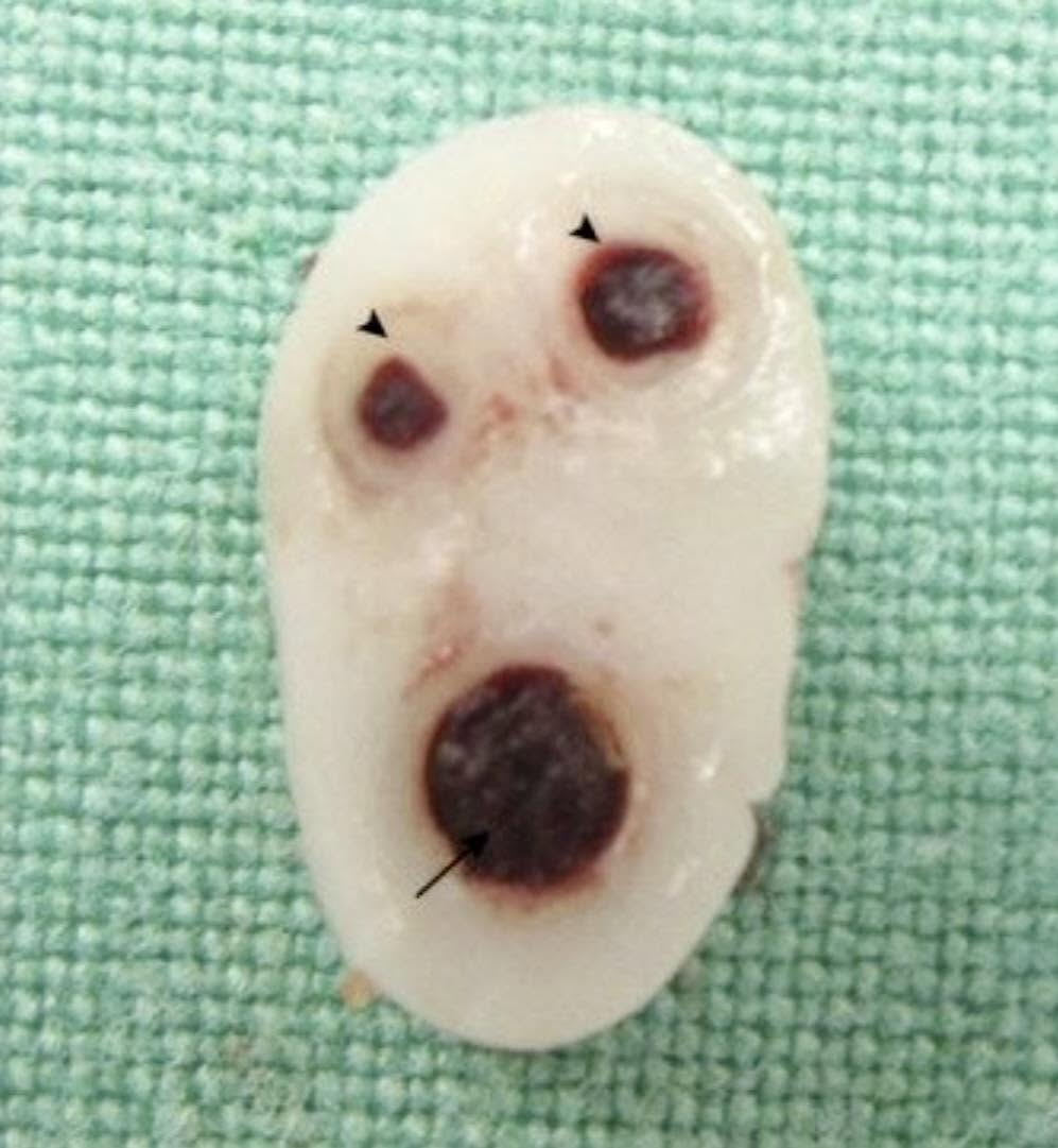 Esto es un corte transversal de un cordón umbilical