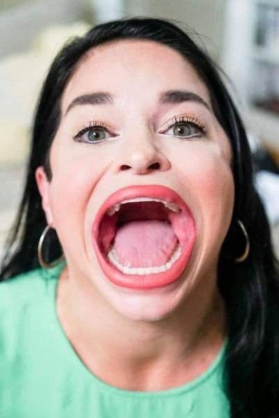 Durante años, Samantha Ramsdell pensó que su boca era solo una rareza