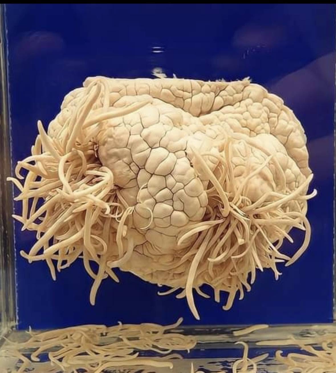 Tokio alberga un lugar que desafía cualquier estómago: el Museo Parasitológico Meguro