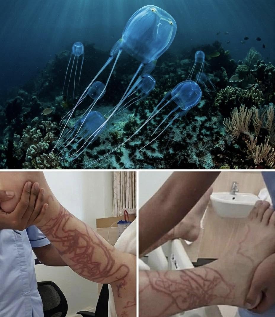 Lo que ves en esta imagen no es un tatuaje, ni una intervención artística, ni mucho menos una pintura sobre la piel