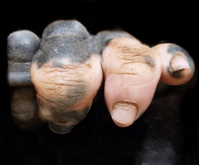 Mano de gorila con vitíligo