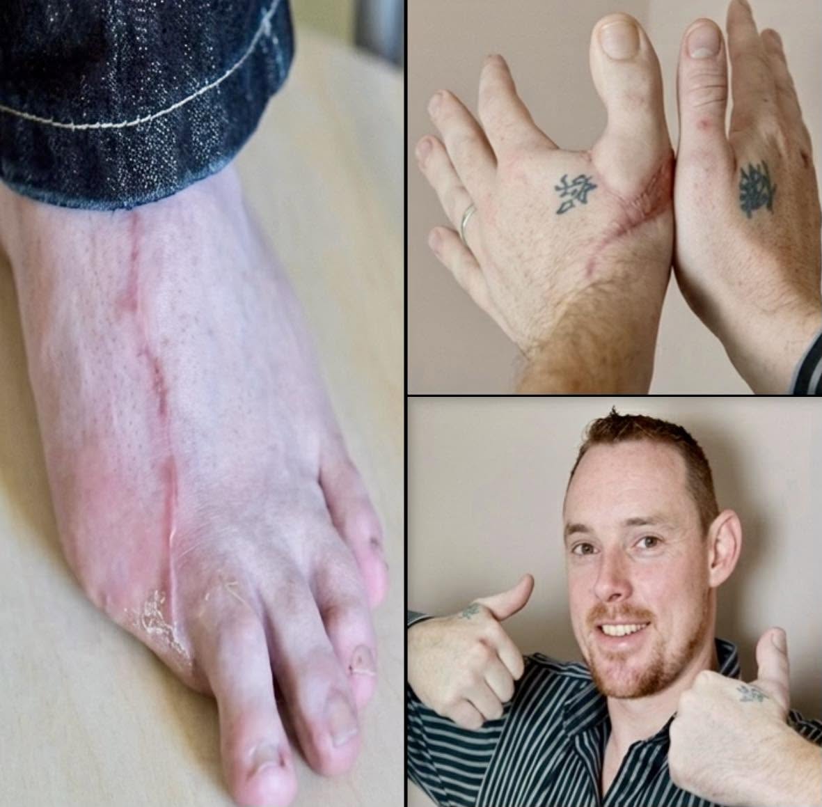 A James Byrne le dijeron que su carrera como pavimentador había terminado cuando un accidente con una sierra circular le arrebató el pulgar izquierd...