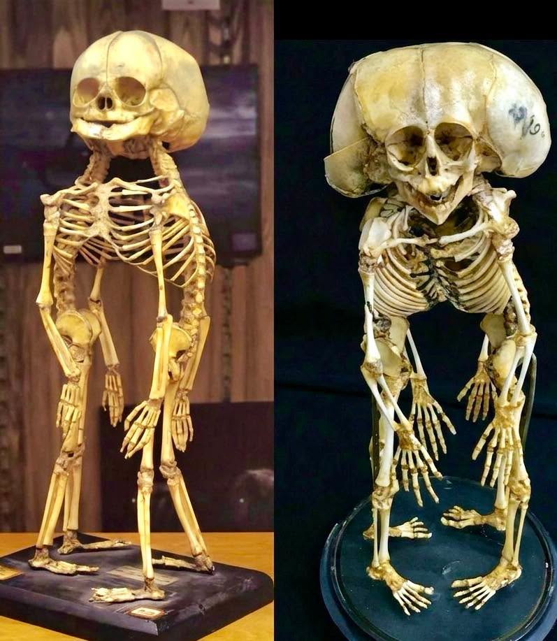 El cuerpo humano guarda misterios médicos capaces de desafiar todo lo que creemos saber