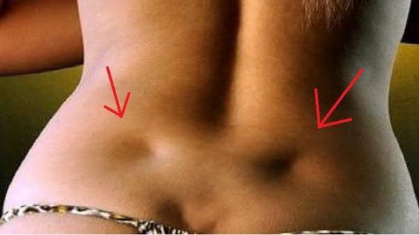 Los hoyuelos en la espalda son simplemente depresiones o hendiduras en la piel de la columna vertebral