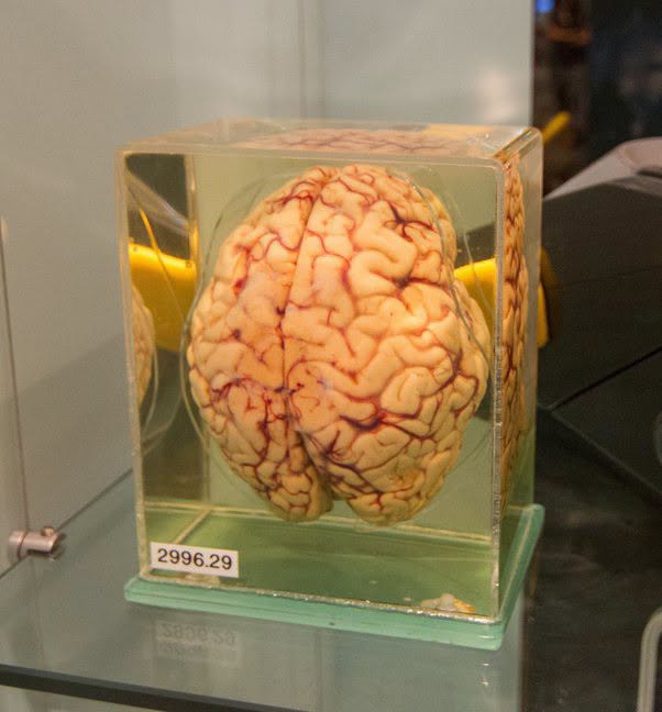 ¿Qué datos sobre el cerebro son poco conocidos
