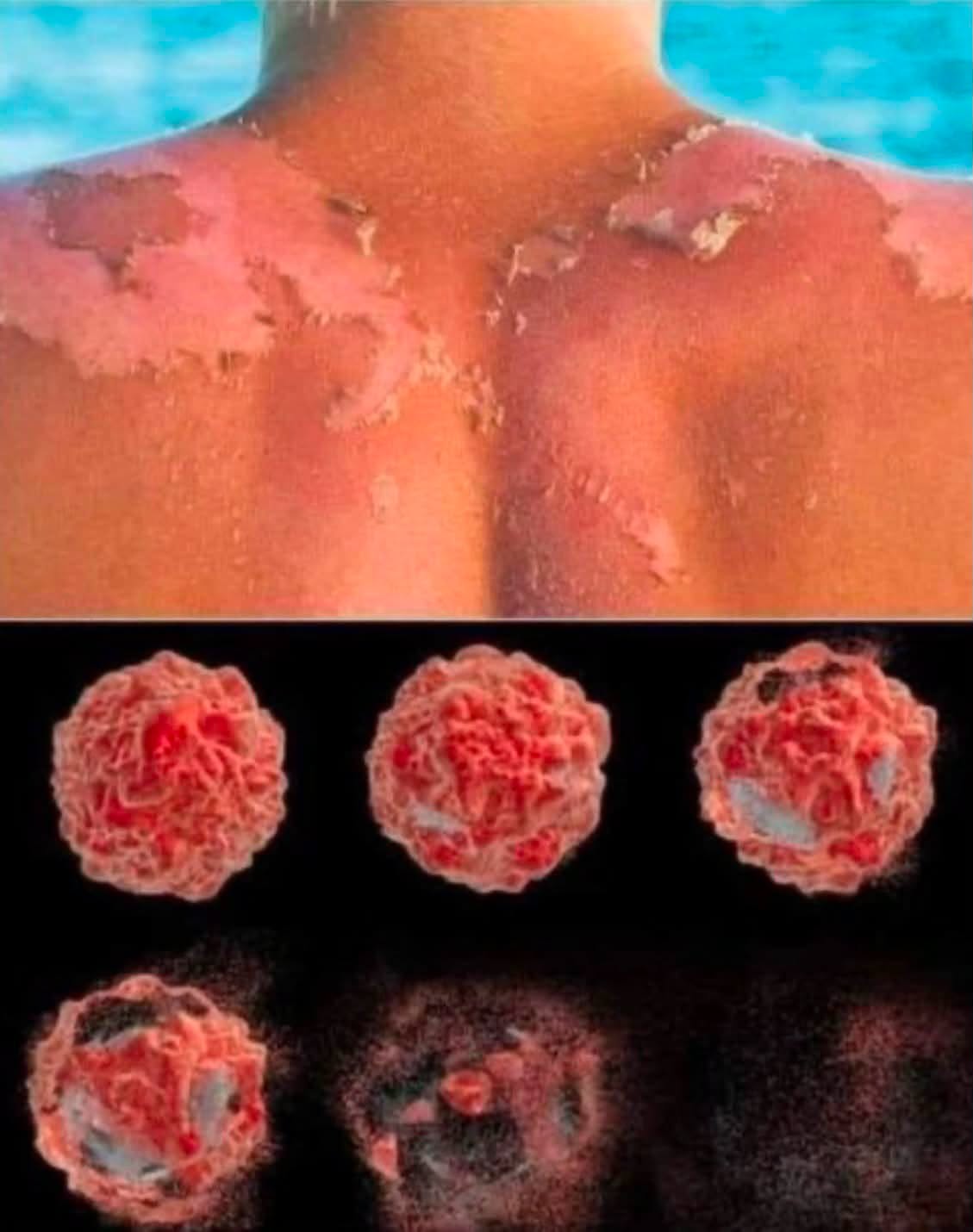 Cuando te quemas con el sol, lo que experimentas en tu piel es mucho más que una simple irritación