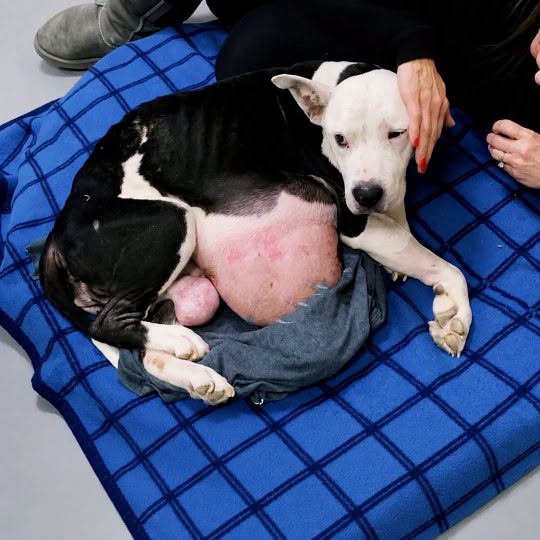Llevaba consigo un tumor de 6 kilos a todas partes