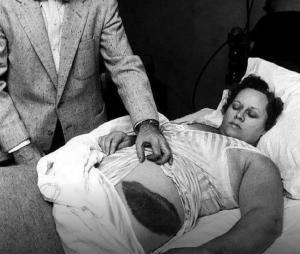 El único meteorito que golpeó a una persona: la increíble historia de Ann Hodges