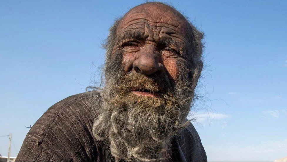 Amou Haji, el hombre más sucio del mundo, murió tras bañarse luego de 60 años