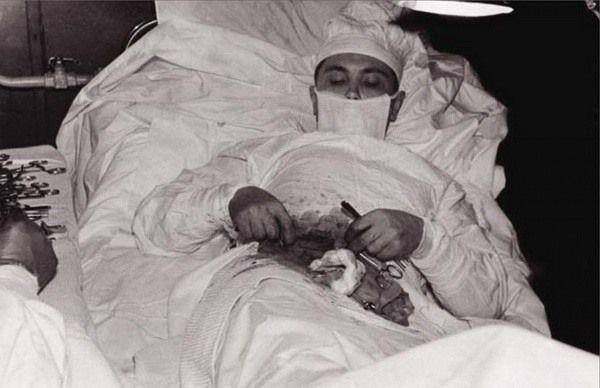 Médico soviético se extirpa su propio apéndice en la Antártida: una hazaña extrema
