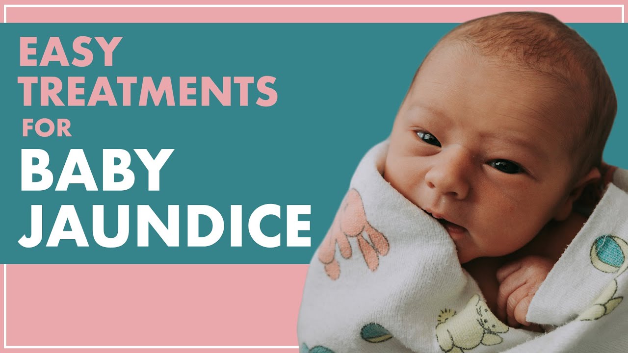 Symptoms Of Jaundice In A Newborn Baby & How to Treat Jaundice In Newborns 