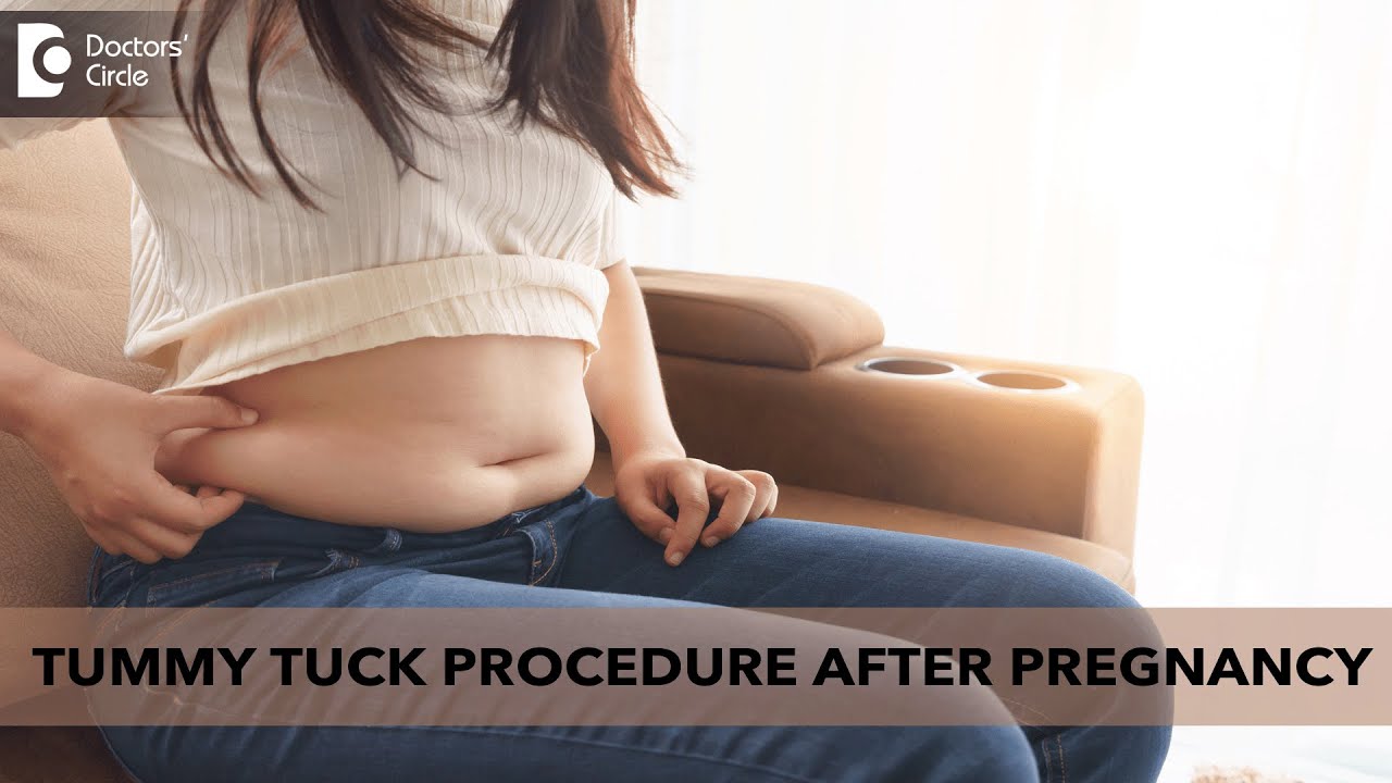 Tummy Tuck to Reduce Loose Skin After Pregnancy & How to Lose Belly Fat After Pregnancy 